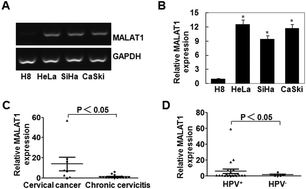Graphical abstract: Down-regulation of MALAT1 inhibits cervical cancer cell invasion and metastasis by inhibition of epithelial–mesenchymal transition