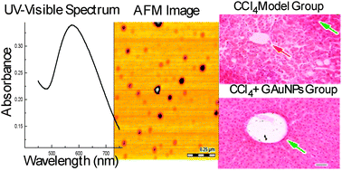 Graphical abstract: Hepatoprotective and urease inhibitory activities of garlic conjugated gold nanoparticles