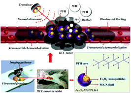 Graphical abstract: Nanoparticle-enhanced synergistic HIFU ablation and transarterial chemoembolization for efficient cancer therapy