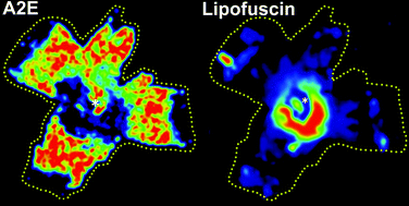 Graphical abstract: A2E and lipofuscin distributions in macaque retinal pigment epithelium are similar to human