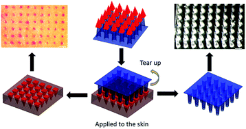 Graphical abstract: Flexible PEGDA-based microneedle patches with detachable PVP–CD arrowheads for transdermal drug delivery