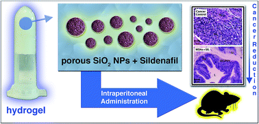 Graphical abstract: Hybrid biomaterial based on porous silica nanoparticles and Pluronic F-127 for sustained release of sildenafil: in vivo study on prostate cancer