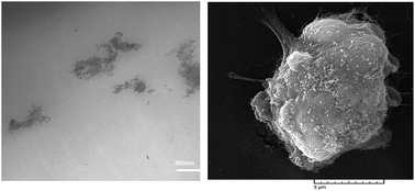 Graphical abstract: Biodegradable polyurethane acrylate/HEMA-grafted nanodiamond composites with bone regenerative potential applications: structure, mechanical properties and biocompatibility