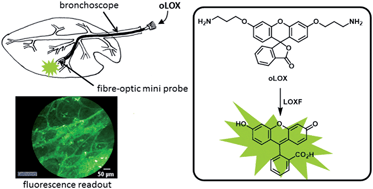 Graphical abstract: Optical molecular imaging of lysyl oxidase activity – detection of active fibrogenesis in human lung tissue