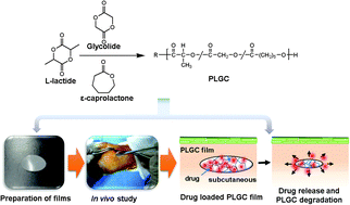Graphical abstract: Biodegradable poly(lactide-co-glycolide-co-ε-caprolactone) block copolymers – evaluation as drug carriers for a localized and sustained delivery system
