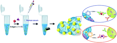 Graphical abstract: Combination assay of lung cancer associated serum markers using surface-enhanced Raman spectroscopy