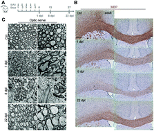 Graphical abstract: TCF7L2 activation is required for myelin regeneration in 5-FU-induced demyelinating mice