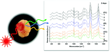 Graphical abstract: Label-free monitoring of tissue biochemistry following traumatic brain injury using Raman spectroscopy