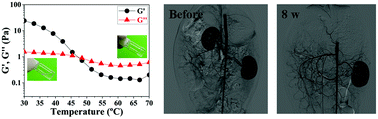 Graphical abstract: A thermoresponsive supramolecular copolymer hydrogel for the embolization of kidney arteries