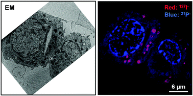 Graphical abstract: High-resolution sub-cellular imaging by correlative NanoSIMS and electron microscopy of amiodarone internalisation by lung macrophages as evidence for drug-induced phospholipidosis