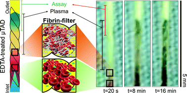 Graphical abstract: EDTA-treated cotton-thread microfluidic device used for one-step whole blood plasma separation and assay