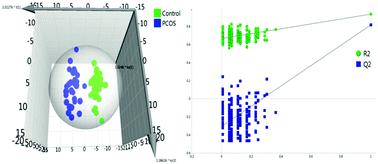 Graphical abstract: Serum metabolomics of Indian women with polycystic ovary syndrome using 1H NMR coupled with a pattern recognition approach