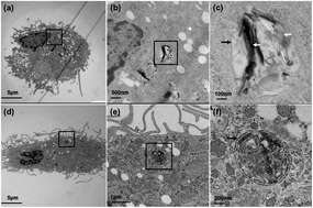 Graphical abstract: A comparison of catabolic pathways induced in primary macrophages by pristine single walled carbon nanotubes and pristine graphene