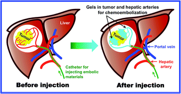 Graphical abstract: Intraarterial gelation of injectable cationic pH/temperature-sensitive radiopaque embolic hydrogels in a rabbit hepatic tumor model and their potential application for liver cancer treatment