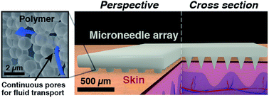 Graphical abstract: Porous polymer microneedles with interconnecting microchannels for rapid fluid transport