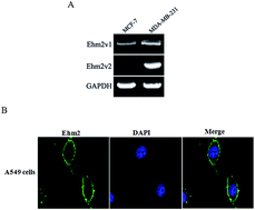 Graphical abstract: The splice variant Ehm2/1 in breast cancer MCF-7 cells interacted with β-catenin and increased its localization to plasma membrane