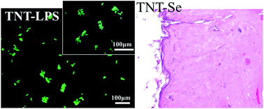 Graphical abstract: Nano-topographic titanium modulates macrophage response in vitro and in an implant-associated rat infection model