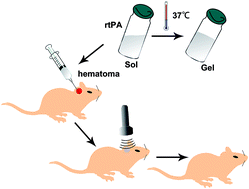 Graphical abstract: A combined therapy of rtPA-loaded thermoresponsive gels and ultrasound on hematoma in a rat model of intracerebral hemorrhage