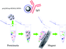 Graphical abstract: Selective removal of IgG from the urine of patients with proteinuria using a polymer coated core–shell magnetic nanoparticle