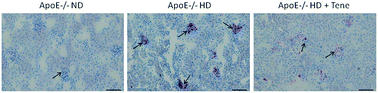 Graphical abstract: The dipeptidyl peptidase-4 inhibitor teneligliptin reduces kidney damage from hypercholesterolemia in apolipoprotein E-deficient mice