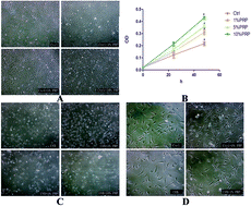 Graphical abstract: Platelet-rich plasma ameliorates senescence-like phenotypes in a cellular photoaging model