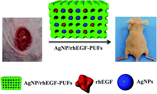 Graphical abstract: AgNP and rhEGF-incorporating synergistic polyurethane foam as a dressing material for scar-free healing of diabetic wounds