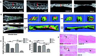 Graphical abstract: Bone marrow mesenchymal stem cell-derived exosomes enhance osteoclastogenesis during alveolar bone deterioration in rats