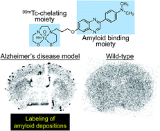 Graphical abstract: Synthesis and biological evaluation of novel technetium-99m-labeled phenylquinoxaline derivatives as single photon emission computed tomography imaging probes targeting β-amyloid plaques in Alzheimer's disease