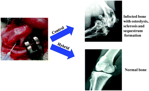 Graphical abstract: Biodegradable poly(ε-caprolactone) as a controlled drug delivery vehicle of vancomycin for the treatment of MRSA infection