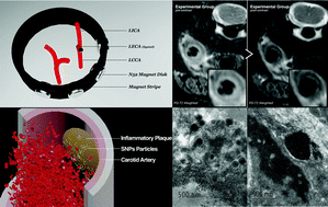 Graphical abstract: Imaging of carotid artery inflammatory plaques with superparamagnetic nanoparticles and an external magnet collar