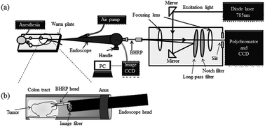 Graphical abstract: Raman endoscopy for monitoring the anticancer drug treatment of colorectal tumors in live mice