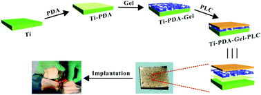 Graphical abstract: The immobilization of antibiotic-loaded polymeric coatings on osteoarticular Ti implants for the prevention of bone infections