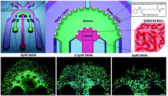 Graphical abstract: Effect of suberoylanilide hydroxamic acid (SAHA) on breast cancer cells within a tumor–stroma microfluidic model