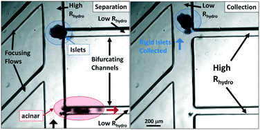 Graphical abstract: Deformability-based microfluidic separation of pancreatic islets from exocrine acinar tissue for transplant applications