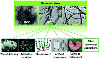 Graphical abstract: Nanocellulose as a sustainable biomass material: structure, properties, present status and future prospects in biomedical applications