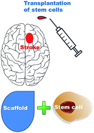Graphical abstract: Stem cell therapies for ischemic stroke: current animal models, clinical trials and biomaterials
