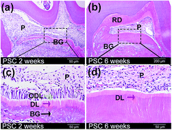 Graphical abstract: Regeneration of dental–pulp complex-like tissue using phytic acid derived bioactive glasses