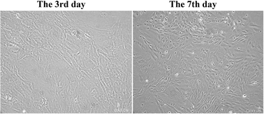 Graphical abstract: Bone marrow mesenchymal stem cells inhibited bleomycin-induced lung fibrosis