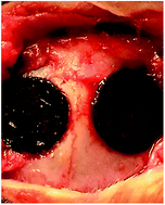 Graphical abstract: Biocompatibility and safety evaluation of a silk fibroin-doped calcium polyphosphate scaffold copolymer in vitro and in vivo