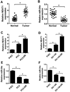 Graphical abstract: Long non-coding RNA NEAT1 contributes to docetaxel resistance of prostate cancer through inducing RET expression by sponging miR-34a