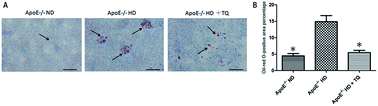 Graphical abstract: Thymoquinone reduces kidney damage in apolipoprotein E-deficient mice fed a high-cholesterol diet