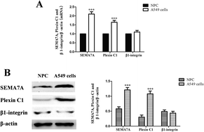 Graphical abstract: The role of semaphorin 7A and its receptor plexin C1 in the migration of NSCLC cells