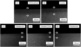 Graphical abstract: The remineralization effectiveness of PAMAM dendrimer with different terminal groups on demineralized dentin in vitro