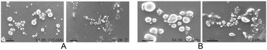 Graphical abstract: In vivo analysis of the effects of CoCrMo and Ti particles on inflammatory responses and osteolysis
