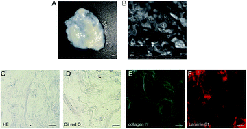 Graphical abstract: VEGF heparinized-decellularized adipose tissue scaffolds enhance tissue engineering vascularization in vitro