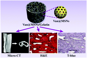 Graphical abstract: Mesoporous silica nanoparticles/gelatin porous composite scaffolds with localized and sustained release of vancomycin for treatment of infected bone defects