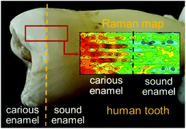 Graphical abstract: Assessment of the Raman spectroscopy effectiveness in determining the early changes in human enamel caused by artificial caries