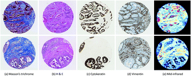 Graphical abstract: Deep learning for FTIR histology: leveraging spatial and spectral features with convolutional neural networks