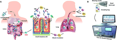 Graphical abstract: Simultaneous detection of hydrogen and methane in breath for the diagnosis of small intestinal bacterial overgrowth by fast gas chromatography