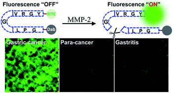 Graphical abstract: Accurate detection of matrix metalloproteinase-2 activity in clinical gastric cancer tissues using a fluorescent probe